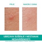 Slika proizvoda URIAGE Hyseac SOS pasta za masnu kožu iz online apoteke Moja Farmacija - BIH