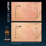 FILORGA DAILY PEEL serum protiv tamnih mrlja