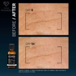 Filorga Daily Peel Noćni Serum Protiv Bora