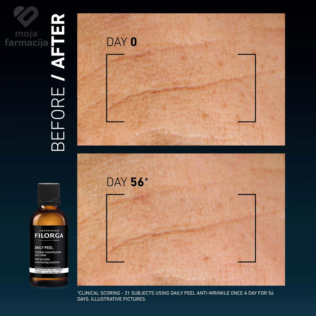 Filorga Daily Peel Noćni Serum Protiv Bora